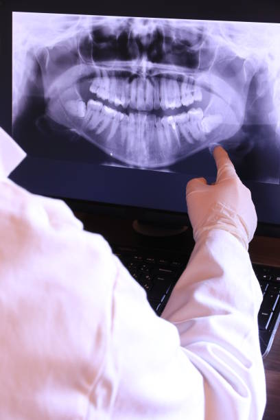 Best Emergency Treatment for Dental Infections or Abscesses in Grove City, OH